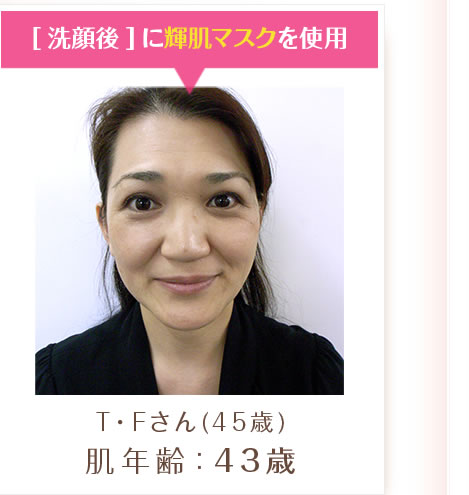 T・Fさん(洗顔後に輝肌マスクを使用) / 肌年齢43歳