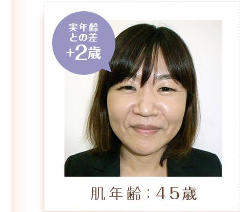 K・Tさん(洗顔後に何もしない) / 10分後の肌年齢45歳