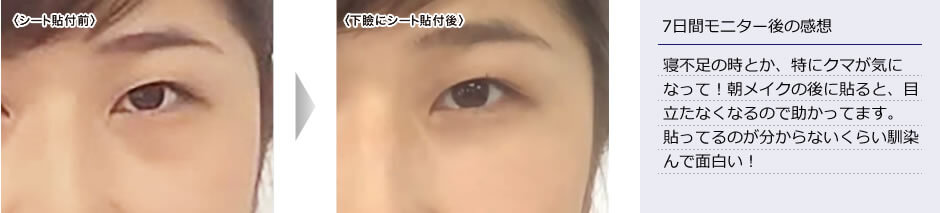 Photo:ビフォーアフター お悩み:クマ